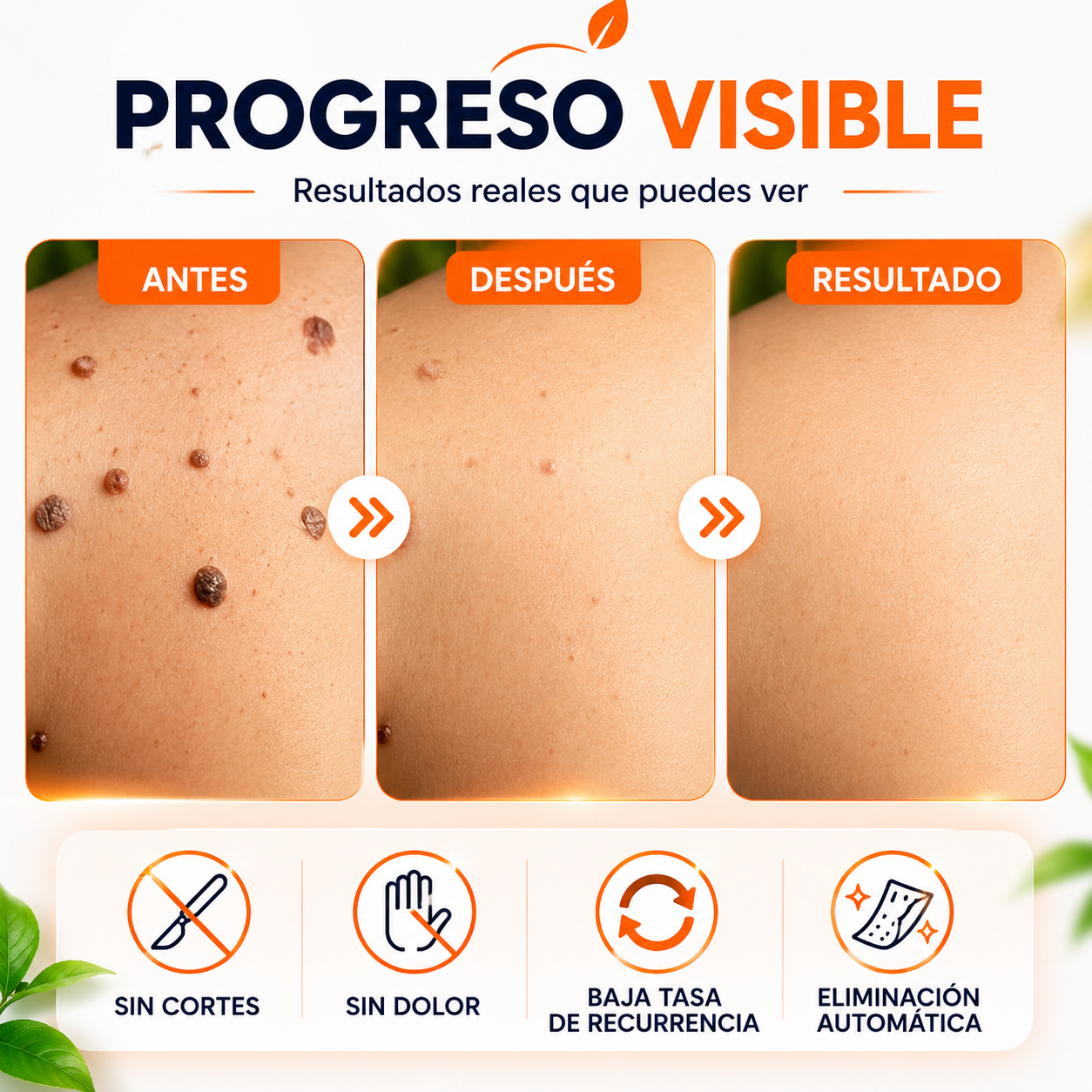 VERRUX™ | Recupera la confianza en tu piel