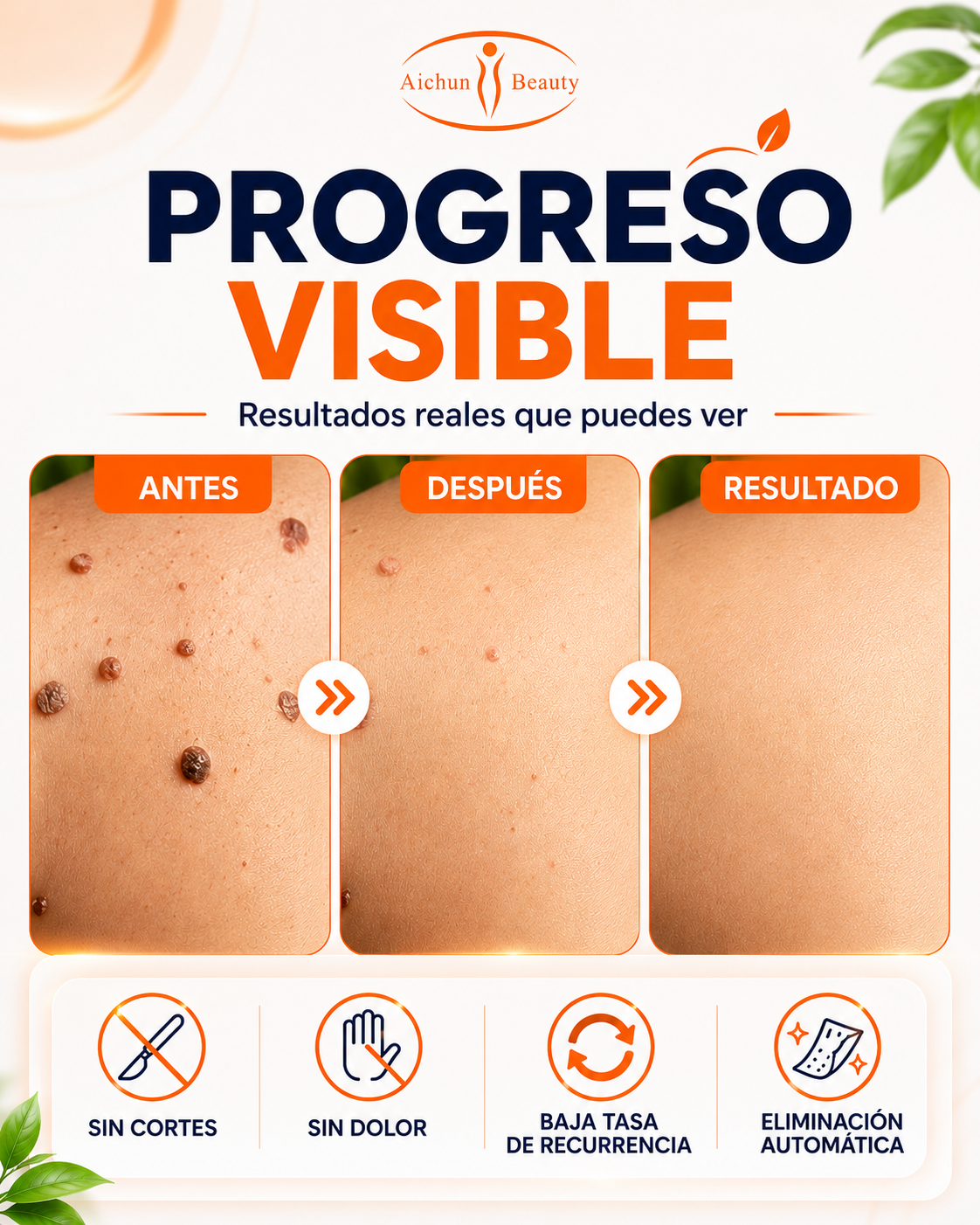 VERRUX™ | Dile adiós a esas verrugas