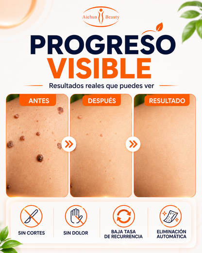 VERRUX™ | Dile adiós a esas verrugas